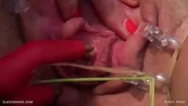 Sex reife frauen gra ...